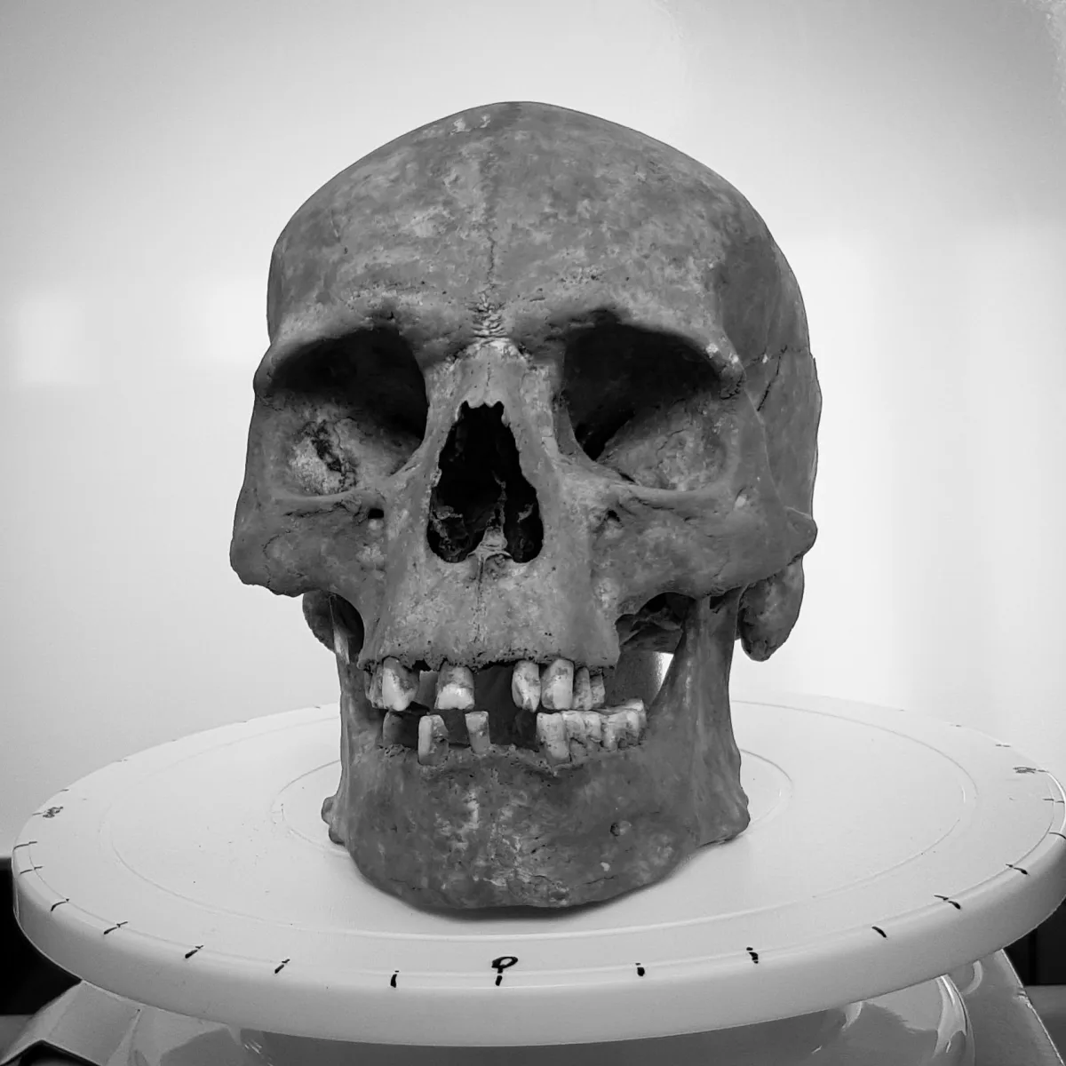 Black and white photo of a human skull placed on a white scanning turntable graduated around its edge